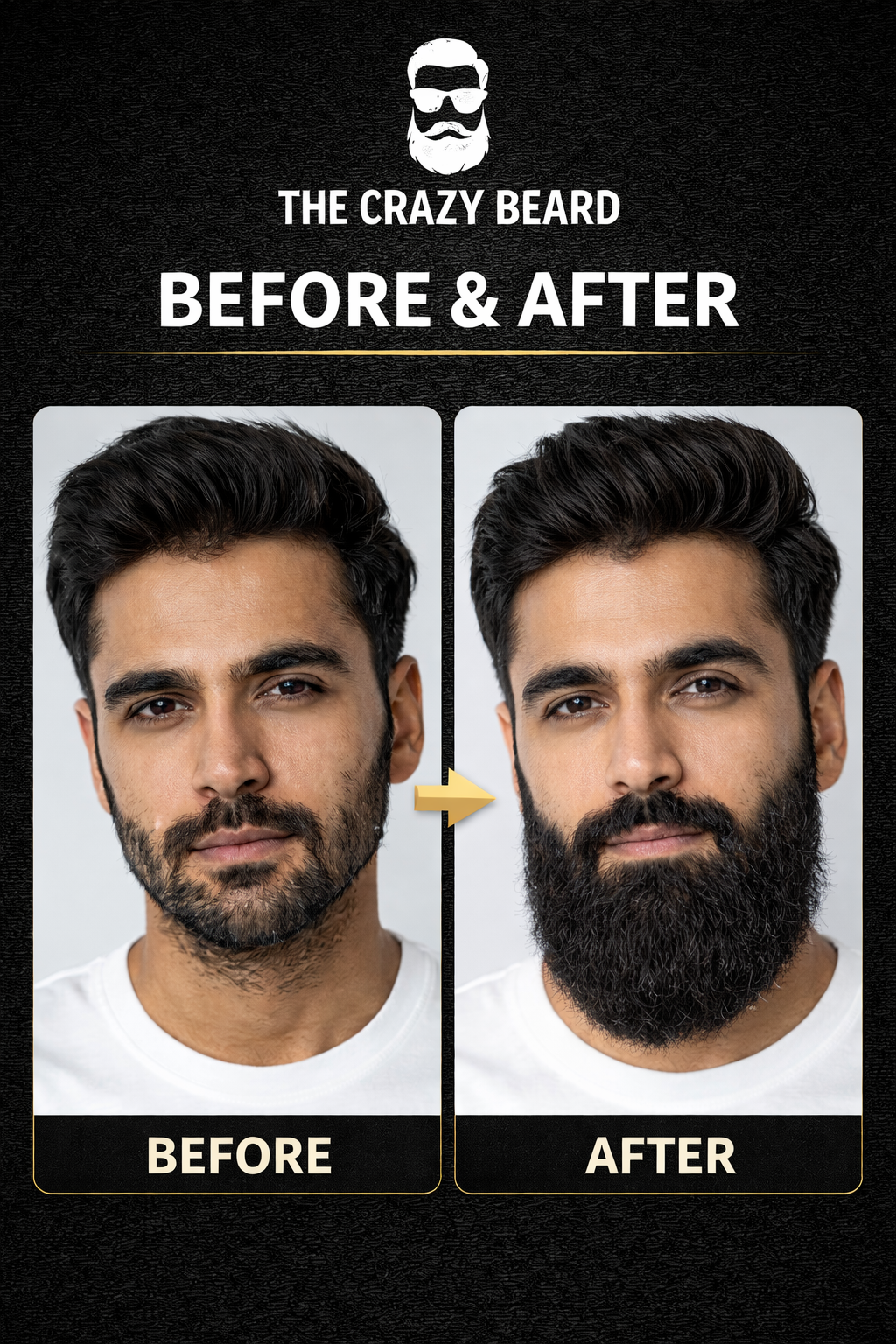 The Crazy Beard  Beard Oil for Men – Hair Growth, Soft & Thick Beard |(Buy 1 Get 1 Free)